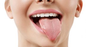 دیدگاه طب سنتی در رابطه با خشکی دهان