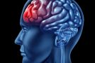 شرایط مغز در زمان اضطراب به چه صورتی است؟