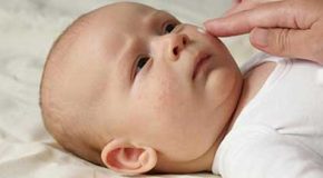 چگونه خشکی پوست نوزادان را پیشگیری و درمان کنیم؟