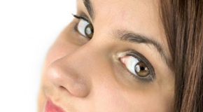 به کمک روشهای خانگی گودی زیر چشم را درمان کنید